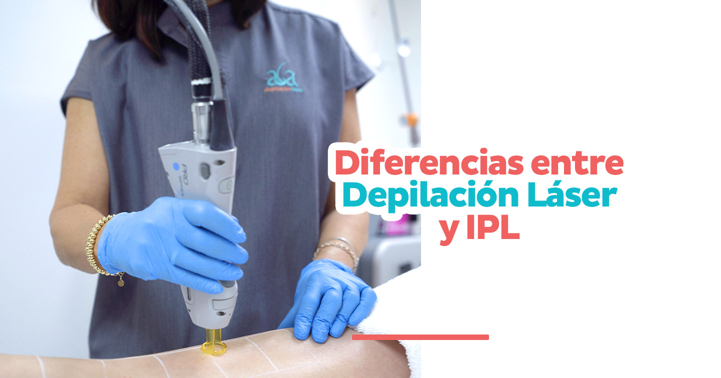 Diferencias entre Depilación Láser y IPL