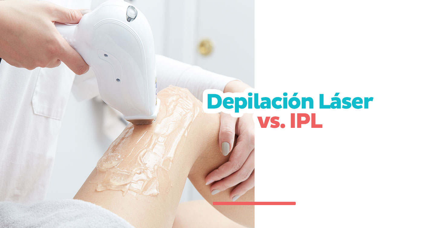 Depilación Láser vs. IPL